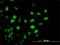 Lysine Acetyltransferase 2B antibody, H00008850-M04, Novus Biologicals, Immunocytochemistry image 