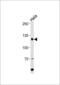 Histone Cell Cycle Regulator antibody, GTX81928, GeneTex, Western Blot image 