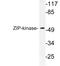 Death Associated Protein Kinase 3 antibody, LS-C177758, Lifespan Biosciences, Western Blot image 