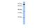 Ring Finger Protein 219 antibody, GTX46905, GeneTex, Western Blot image 