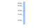 Zinc Finger Protein 385D antibody, PA5-69712, Invitrogen Antibodies, Western Blot image 