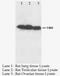 Matrix Metallopeptidase 8 antibody, LS-C171956, Lifespan Biosciences, Western Blot image 