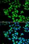 Microtubule Associated Protein 1 Light Chain 3 Beta antibody, LS-C746932, Lifespan Biosciences, Immunofluorescence image 