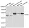 Cyclin Dependent Kinase Inhibitor 2D antibody, A04390, Boster Biological Technology, Western Blot image 