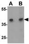 B And T Lymphocyte Associated antibody, GTX31892, GeneTex, Western Blot image 