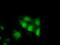 Tetratricopeptide Repeat Domain 32 antibody, NBP2-02691, Novus Biologicals, Immunofluorescence image 