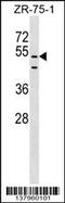 PDZ Domain Containing 3 antibody, 59-347, ProSci, Western Blot image 