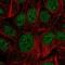 Zinc Finger DHHC-Type Containing 12 antibody, NBP2-31763, Novus Biologicals, Immunocytochemistry image 