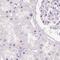 N-terminal EF-hand calcium-binding protein 2 antibody, PA5-53127, Invitrogen Antibodies, Immunohistochemistry paraffin image 