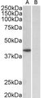 TATA-Box Binding Protein antibody, TA348995, Origene, Western Blot image 