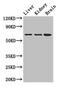 Adenylate Kinase 5 antibody, CSB-PA897315LA01HU, Cusabio, Western Blot image 