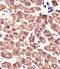 ATP Synthase F1 Subunit Beta antibody, MBS9208061, MyBioSource, Immunohistochemistry paraffin image 