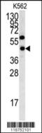 Ly1 Antibody Reactive antibody, 62-827, ProSci, Western Blot image 