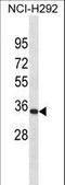 Paired Related Homeobox 1 antibody, LS-C155849, Lifespan Biosciences, Western Blot image 