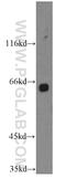 Transmembrane 7 Superfamily Member 3 antibody, 19826-1-AP, Proteintech Group, Western Blot image 
