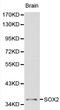 Quiescin Sulfhydryl Oxidase 1 antibody, LS-C192381, Lifespan Biosciences, Western Blot image 