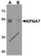 Karyopherin Subunit Alpha 7 antibody, 5993, ProSci Inc, Western Blot image 