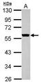 Keratin 8 antibody, PA5-34762, Invitrogen Antibodies, Western Blot image 