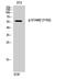 Signal Transducing Adaptor Molecule 2 antibody, A06533Y192-1, Boster Biological Technology, Western Blot image 