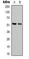 Alpha-1-antitrypsin antibody, abx133762, Abbexa, Western Blot image 