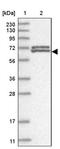 Zinc Finger Protein 8 antibody, PA5-57062, Invitrogen Antibodies, Western Blot image 