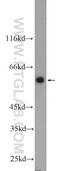 Dynein Cytoplasmic 1 Light Intermediate Chain 1 antibody, 25326-1-AP, Proteintech Group, Western Blot image 