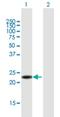 Ankyrin Repeat Domain 7 antibody, H00056311-B01P, Novus Biologicals, Western Blot image 