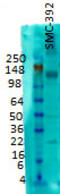 Solute Carrier Family 12 Member 5 antibody, TA326588, Origene, Western Blot image 
