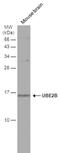 Ubiquitin-conjugating enzyme E2 B antibody, NBP1-31293, Novus Biologicals, Western Blot image 