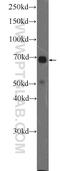 Mitogen-Activated Protein Kinase 7 antibody, 11164-1-AP, Proteintech Group, Western Blot image 