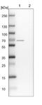 Transmembrane Serine Protease 7 antibody, NBP1-90893, Novus Biologicals, Western Blot image 