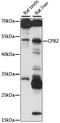 Carboxypeptidase B2 antibody, LS-C750236, Lifespan Biosciences, Western Blot image 