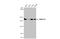 SWI/SNF Related, Matrix Associated, Actin Dependent Regulator Of Chromatin, Subfamily A, Member 2 antibody, GTX636329, GeneTex, Western Blot image 