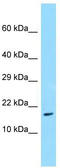 Trafficking Protein Particle Complex 3 antibody, TA331302, Origene, Western Blot image 