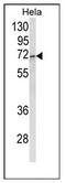 ASPSCR1 Tether For SLC2A4, UBX Domain Containing antibody, AP17891PU-N, Origene, Western Blot image 