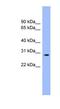 Enolase-Phosphatase 1 antibody, NBP1-55361, Novus Biologicals, Western Blot image 