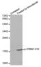 Stathmin 1 antibody, abx000281, Abbexa, Western Blot image 