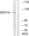 Adenylate Cyclase 4 antibody, abx013895, Abbexa, Western Blot image 