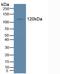 Tyrosine Kinase With Immunoglobulin Like And EGF Like Domains 1 antibody, LS-C314405, Lifespan Biosciences, Western Blot image 