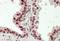 Homeobox D13 antibody, orb20481, Biorbyt, Immunohistochemistry paraffin image 