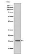 H3 Histone Family Member 3B antibody, MP06819, Boster Biological Technology, Western Blot image 