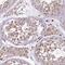 Tetratricopeptide Repeat Domain 12 antibody, NBP2-58627, Novus Biologicals, Immunohistochemistry paraffin image 