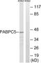 Poly(A) Binding Protein Cytoplasmic 5 antibody, A14533, Boster Biological Technology, Western Blot image 