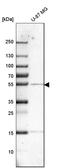 Cathepsin A antibody, HPA031068, Atlas Antibodies, Western Blot image 