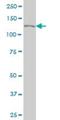 Cullin Associated And Neddylation Dissociated 1 antibody, H00055832-M03, Novus Biologicals, Western Blot image 