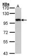 ADAM Metallopeptidase Domain 15 antibody, GTX101599, GeneTex, Western Blot image 