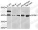 Opioid Receptor Kappa 1 antibody, A8306, ABclonal Technology, Western Blot image 