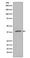 NFKB Inhibitor Alpha antibody, P01139, Boster Biological Technology, Western Blot image 