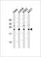 Interleukin-24 antibody, M03793, Boster Biological Technology, Western Blot image 