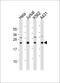 Interleukin 24 antibody, M03793, Boster Biological Technology, Western Blot image 